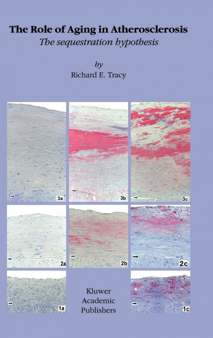 The Role of Aging in Atherosclerosis