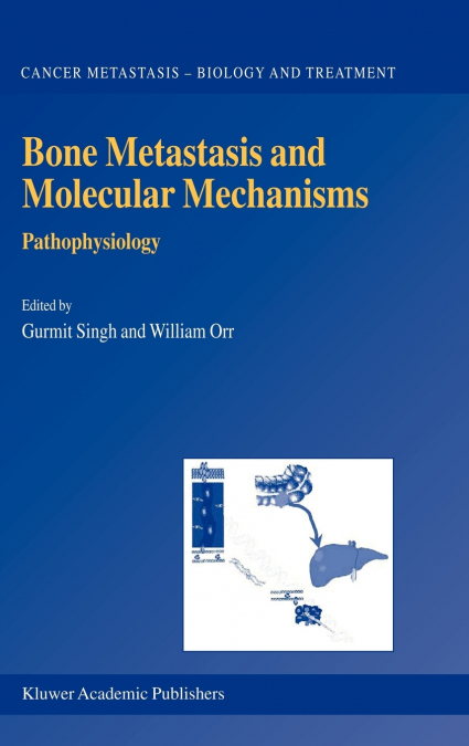 Bone Metastasis and Molecular Mechanisms