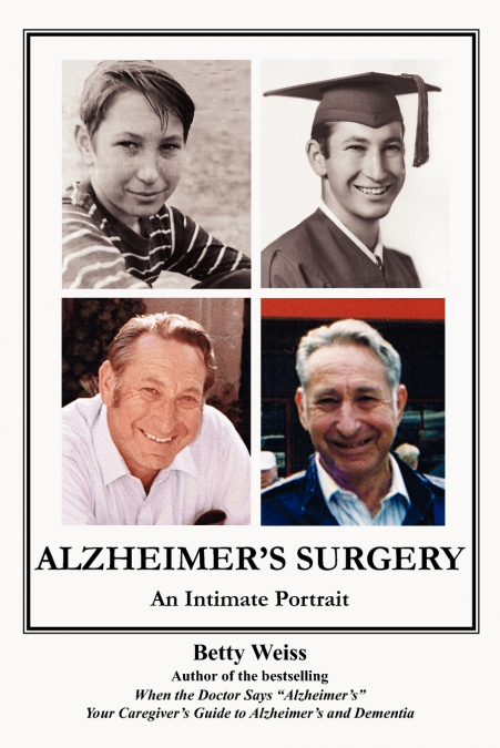 Alzheimer’s Surgery