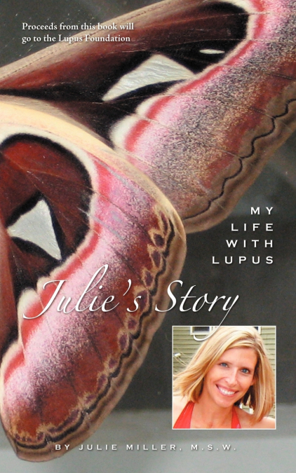 Julie’s Story, My Life With Lupus