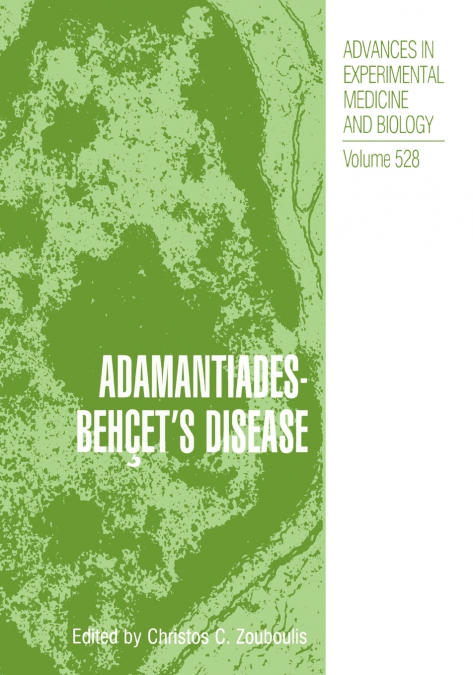 Adamantiades-Behçet’s Disease