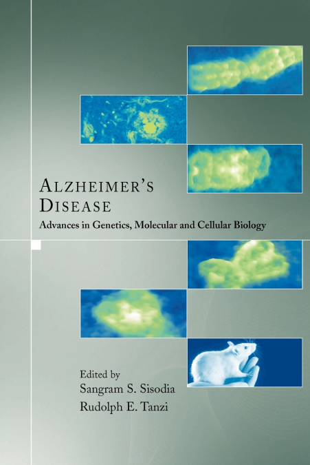 Alzheimer’s Disease