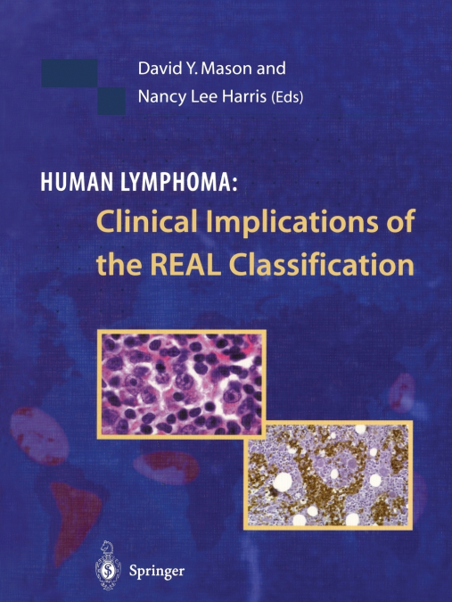 Human Lymphoma