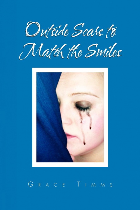 Outside Scars to Match the Smiles