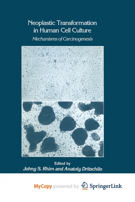Neoplastic Transformation in Human Cell Culture