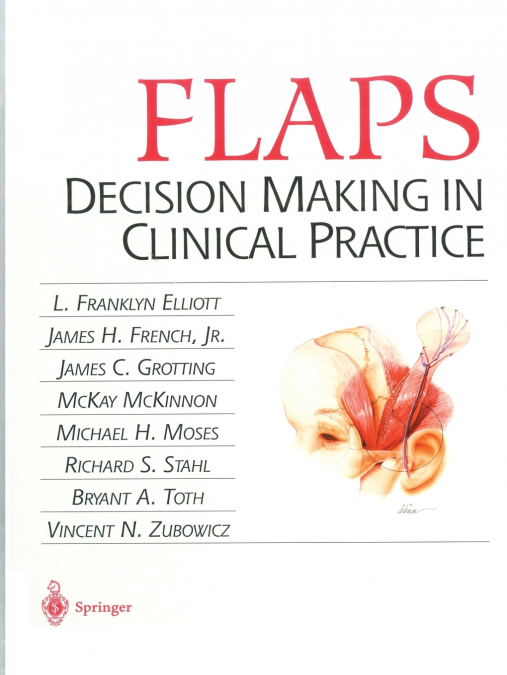 Flaps