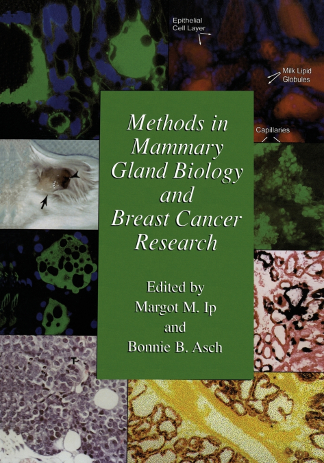 Methods in Mammary Gland Biology and Breast Cancer Research