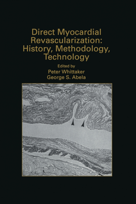 Direct Myocardial Revascularization