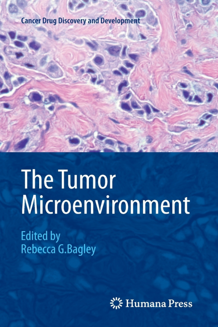 The Tumor Microenvironment