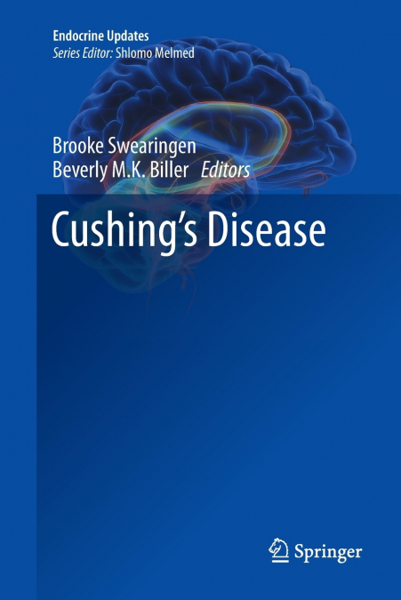 Cushing’s Disease