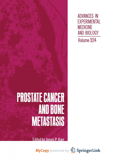 Prostate Cancer and Bone Metastasis