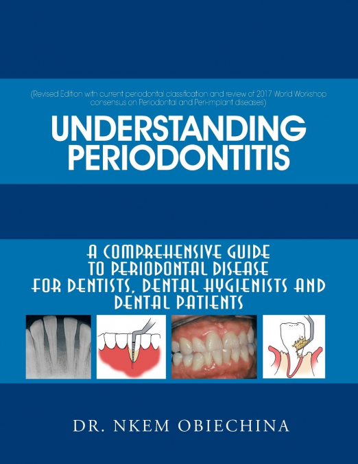 Understanding Periodontitis
