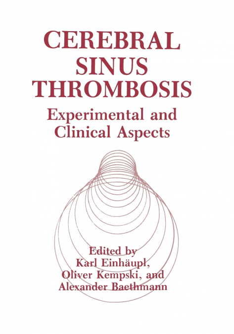Cerebral Sinus Thrombosis