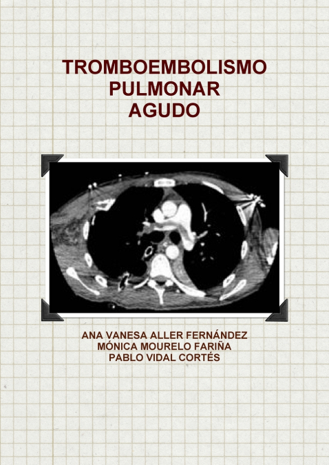 TROMBOEMBOLISMO PULMONAR AGUDO