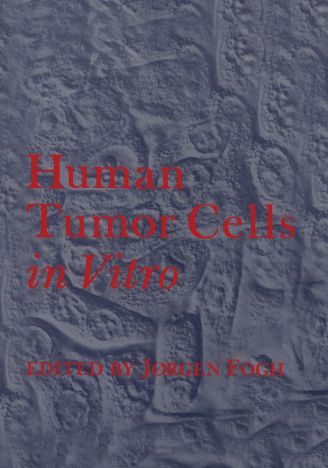 Human Tumor Cells in Vitro