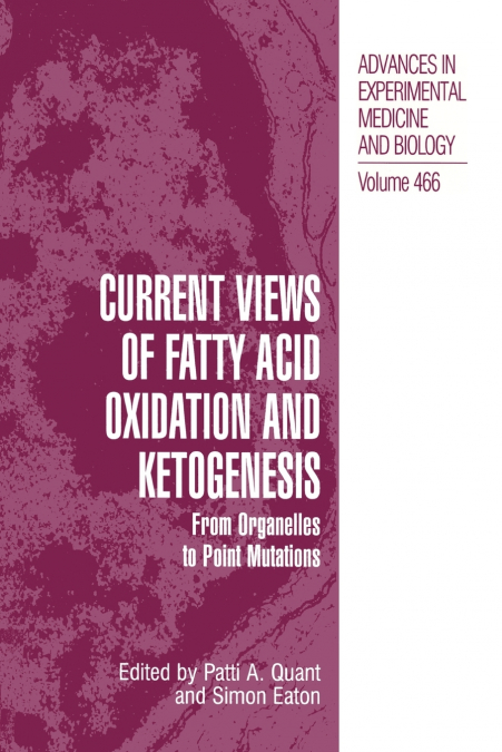 Current Views of Fatty Acid Oxidation and Ketogenesis