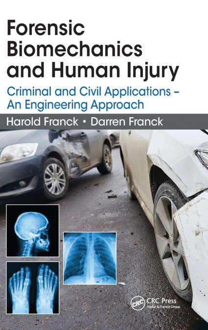 Forensic Biomechanics and Human Injury