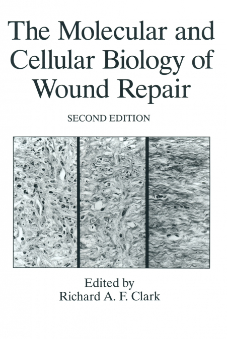The Molecular and Cellular Biology of Wound Repair
