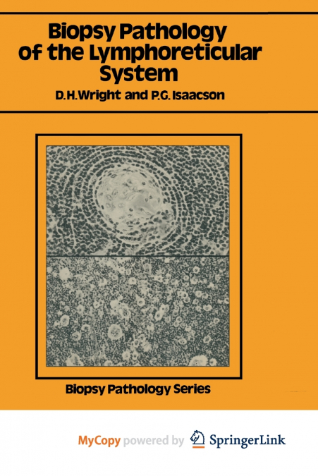 Biopsy Pathology of the Lymphoreticular System