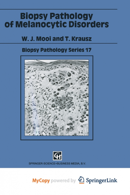 Biopsy Pathology of Melanocytic Disorders
