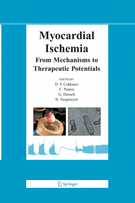 Myocardial Ischemia
