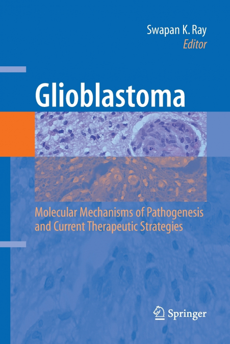 Glioblastoma
