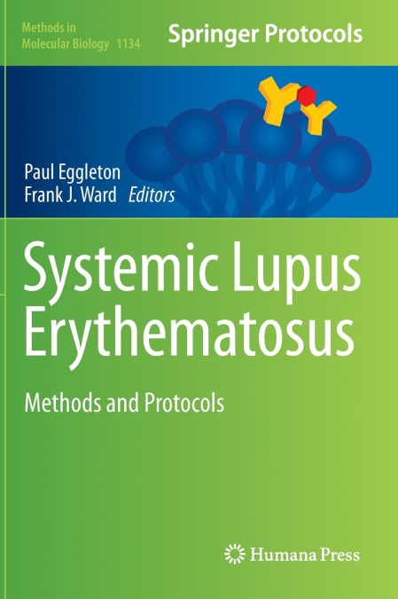 Systemic Lupus Erythematosus