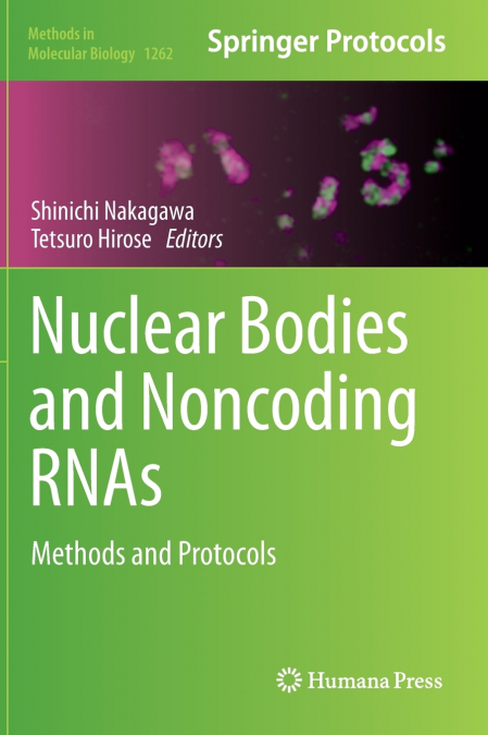 Nuclear Bodies and Noncoding RNAs