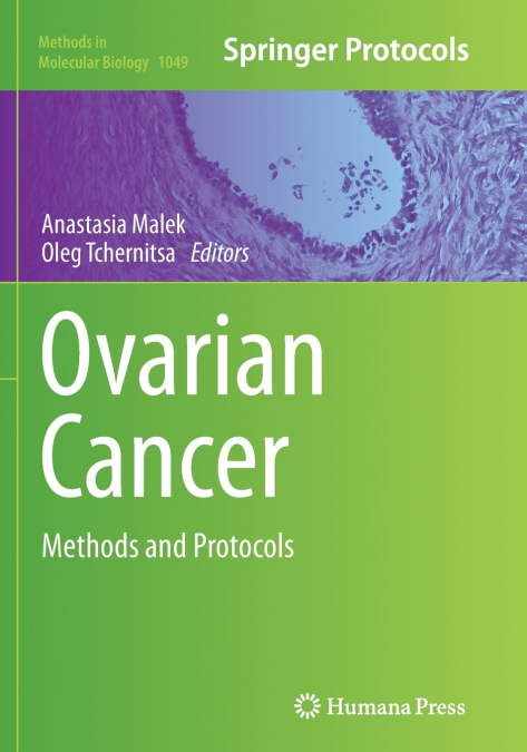 Ovarian Cancer