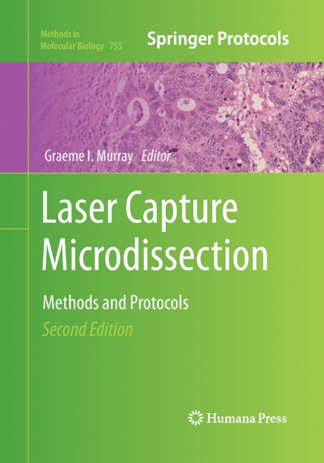 Laser Capture Microdissection