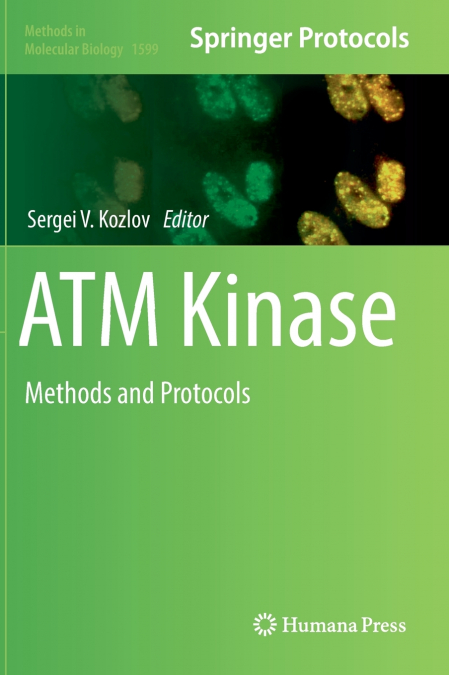 ATM Kinase