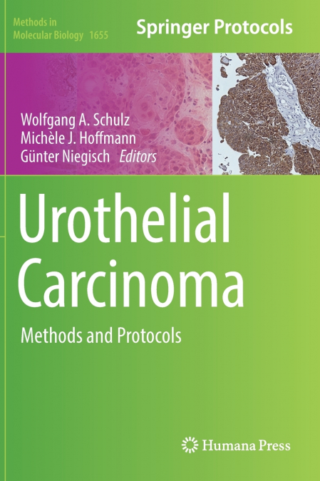 Urothelial Carcinoma