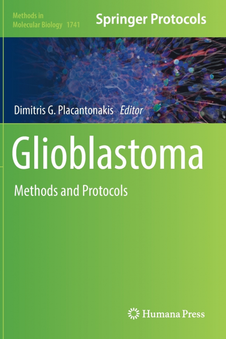 Glioblastoma