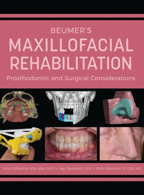 Beumer’s Maxillofacial Rehabilitation