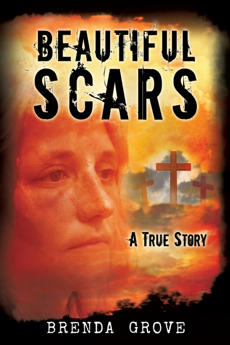BEAUTIFUL SCARS