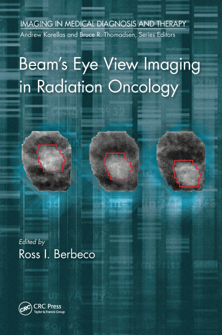 Beam’s Eye View Imaging in Radiation Oncology