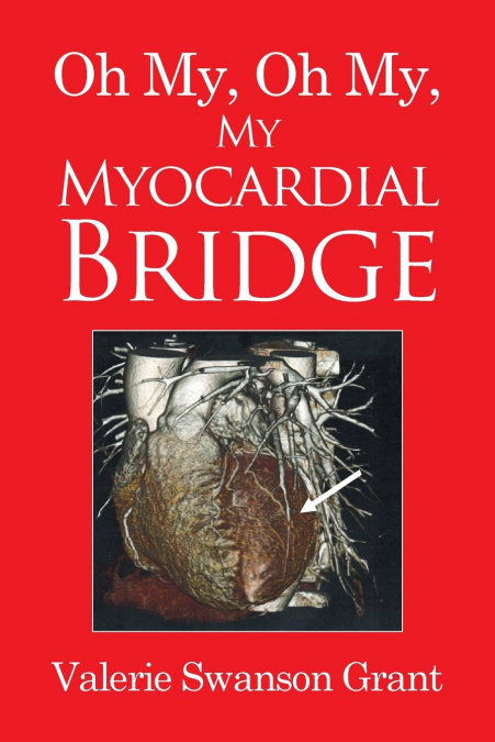 Oh My, Oh My, My Myocardial Bridge