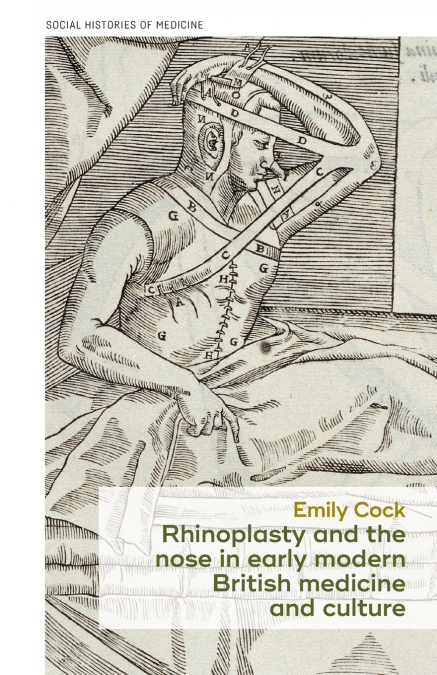 Rhinoplasty and the nose in early modern British medicine and culture
