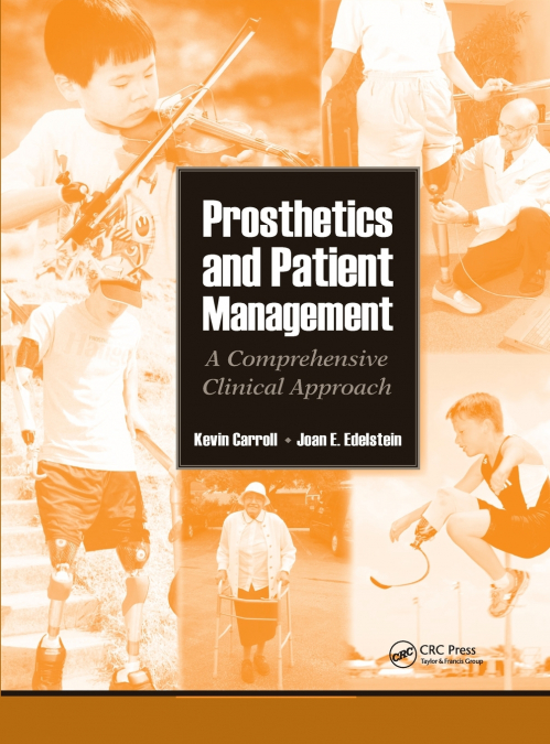 Prosthetics and Patient Management