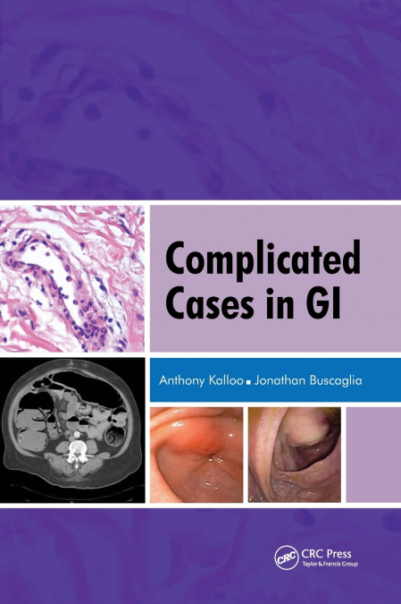 Complicated Cases in GI