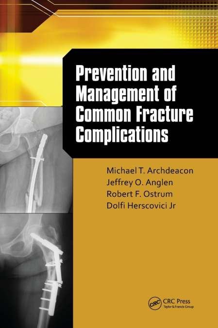 Prevention and Management of Common Fracture Complications