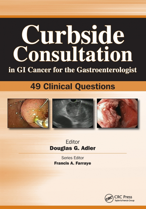 Curbside Consultation in GI Cancer for the Gastroenterologist