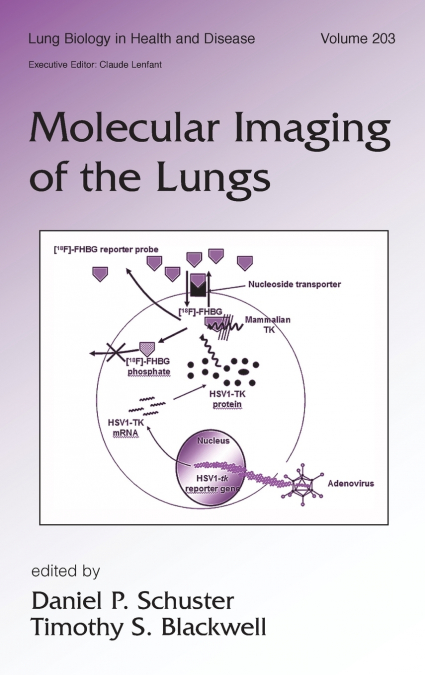 Molecular Imaging of the Lungs