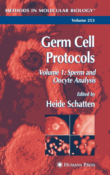 Germ Cell Protocols