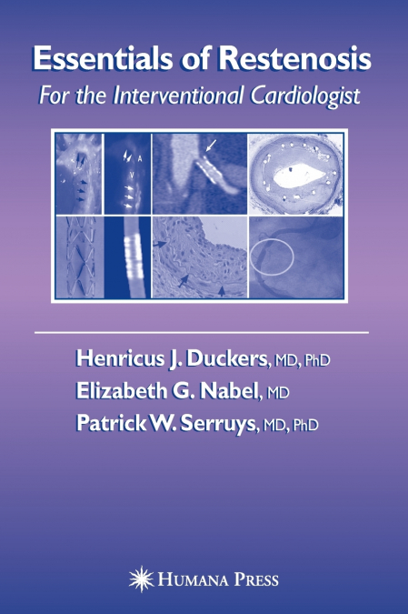 Essentials of Restenosis