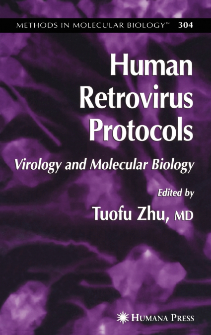 Human Retrovirus Protocols