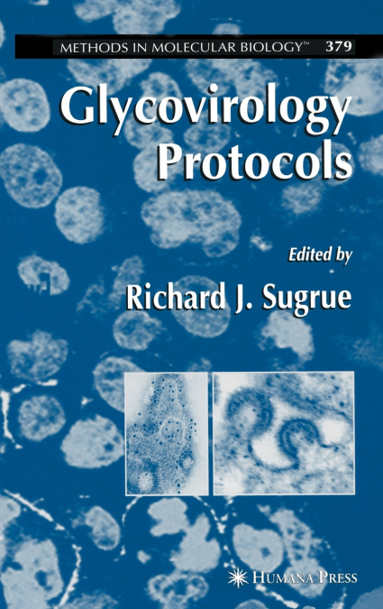 Glycovirology Protocols