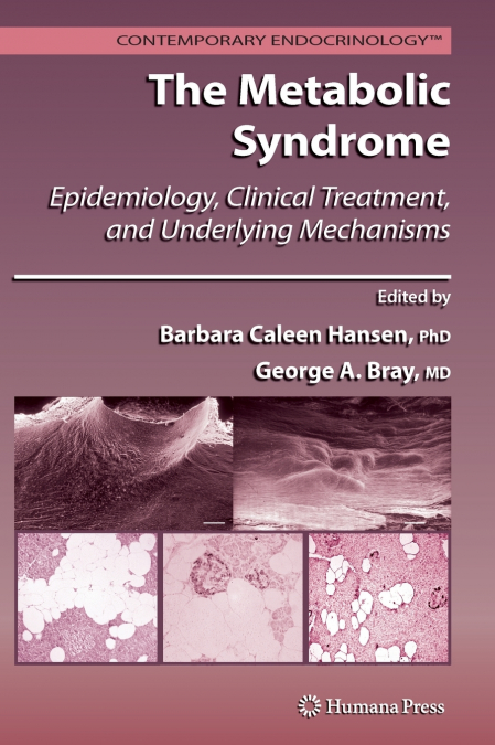 The Metabolic Syndrome