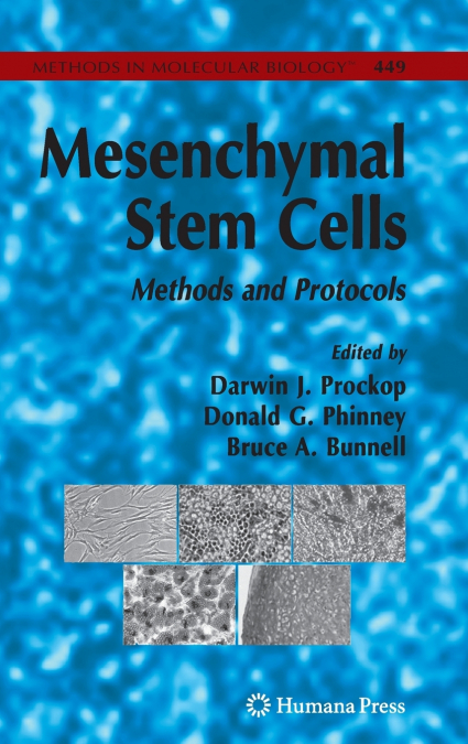 Mesenchymal Stem Cells