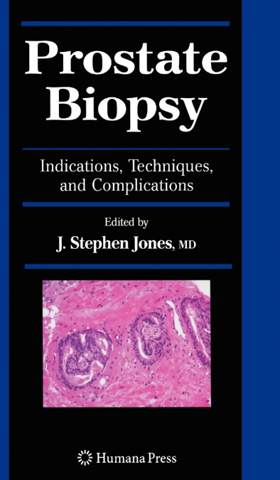 Prostate Biopsy
